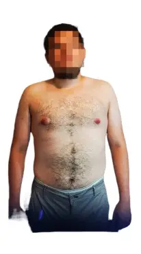 Fernando antes