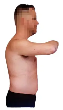 Miguel después